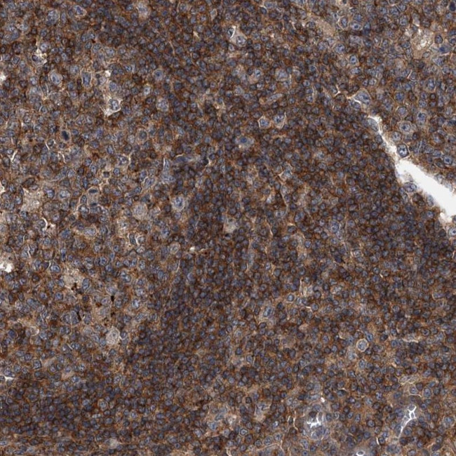 PAN3 Antibody in Immunohistochemistry (Paraffin) (IHC (P))