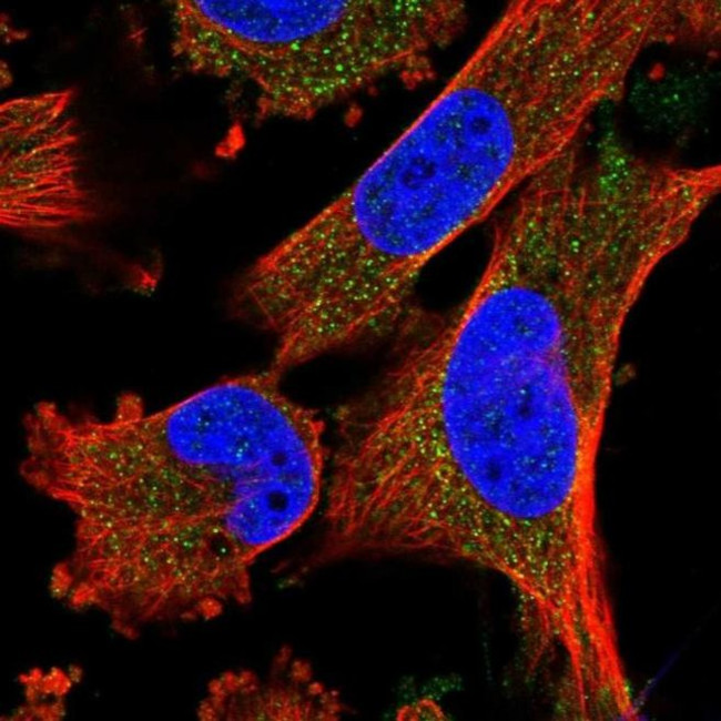 FREM2 Antibody in Immunocytochemistry (ICC/IF)