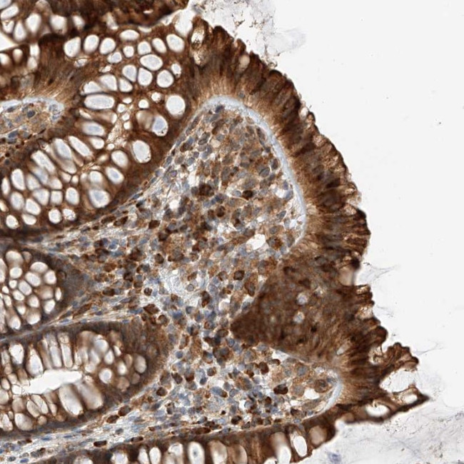 ZNF84 Antibody in Immunohistochemistry (Paraffin) (IHC (P))