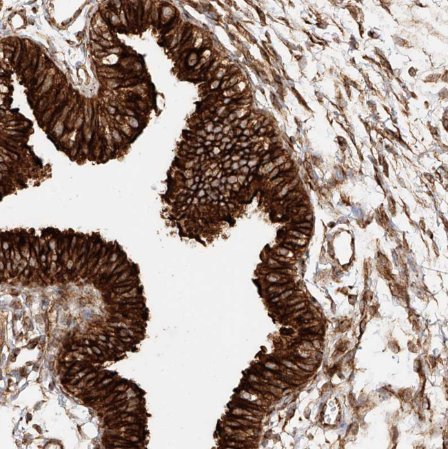 NAP1L1 Antibody in Immunohistochemistry (Paraffin) (IHC (P))