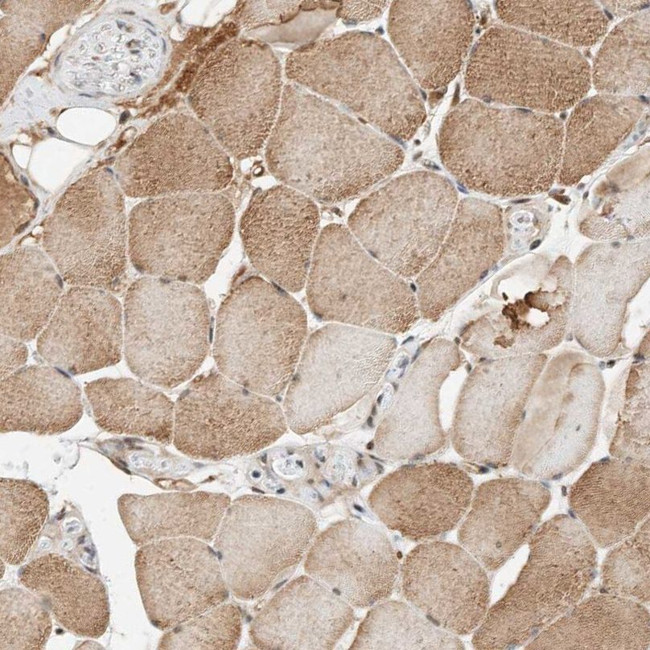 THTPA Antibody in Immunohistochemistry (IHC)