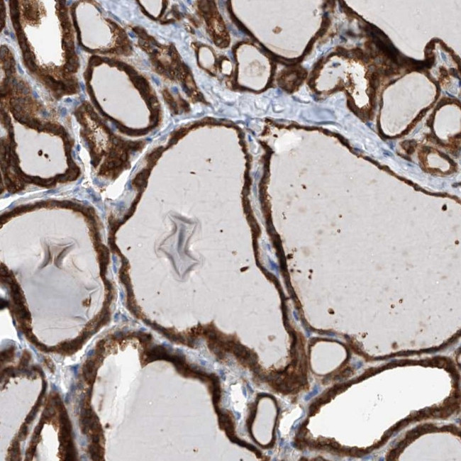 OR4K1 Antibody in Immunohistochemistry (Paraffin) (IHC (P))