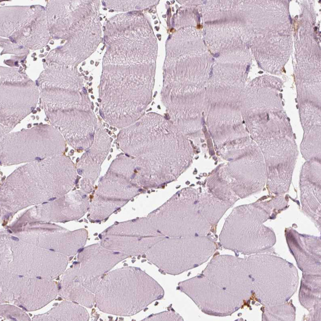 RNF36 Antibody in Immunohistochemistry (Paraffin) (IHC (P))