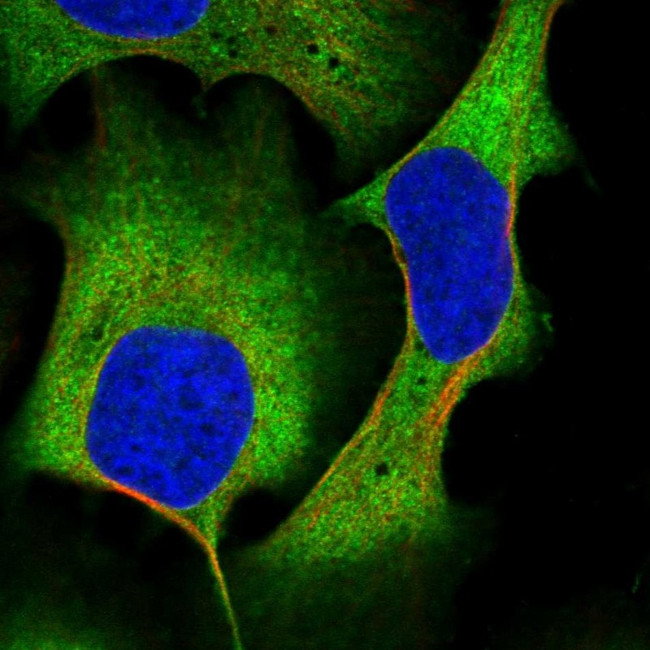 AKAP10 Antibody in Immunocytochemistry (ICC/IF)