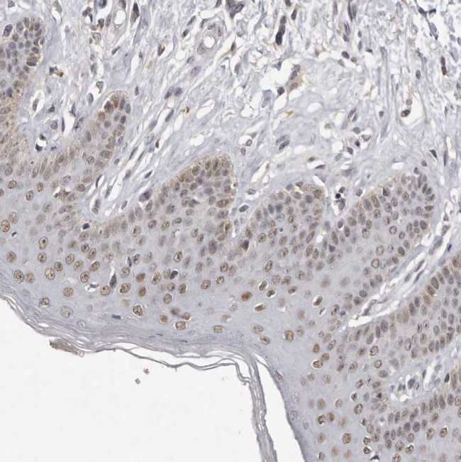 SRCAP Antibody in Immunohistochemistry (Paraffin) (IHC (P))