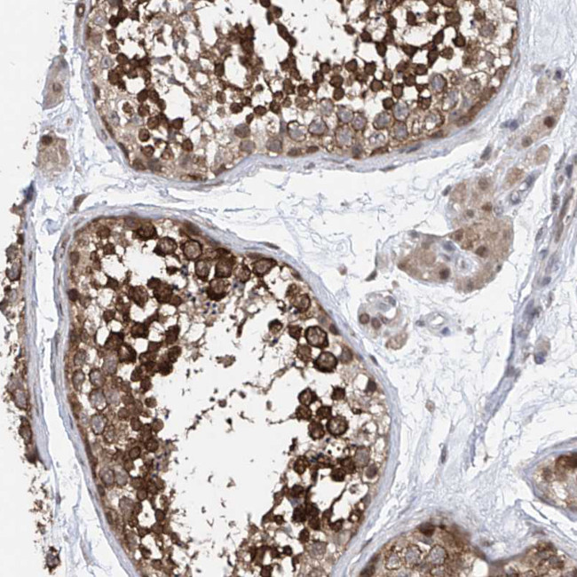 Centrin 1 Antibody in Immunohistochemistry (Paraffin) (IHC (P))