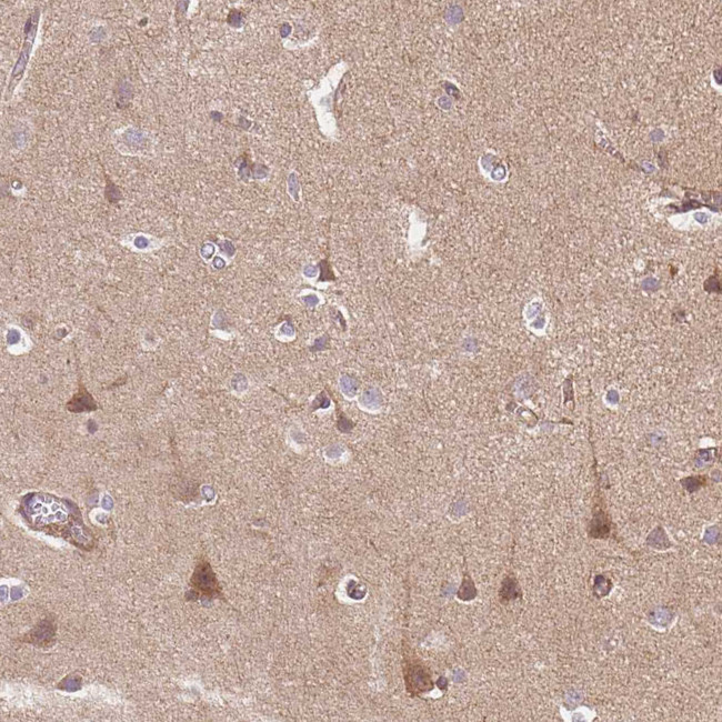 APLP1 Antibody in Immunohistochemistry (Paraffin) (IHC (P))