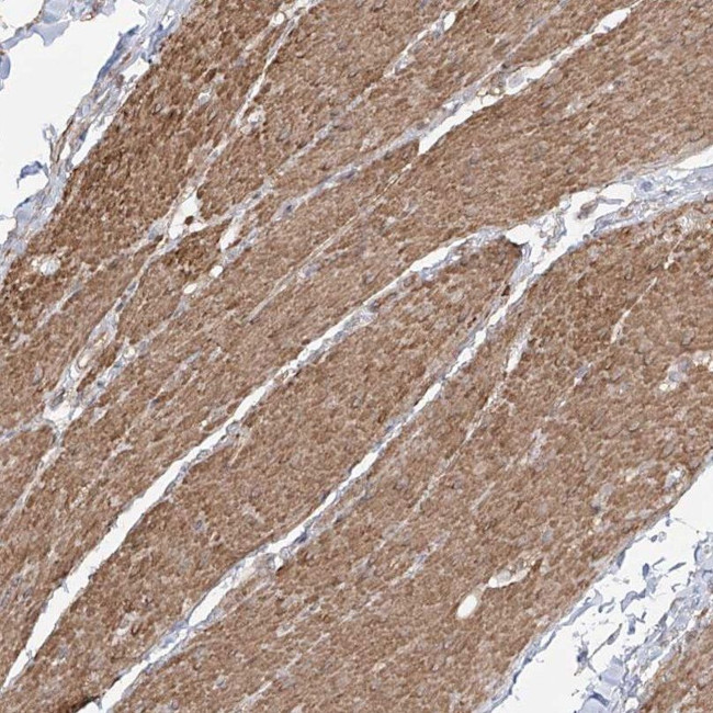 ZNF180 Antibody in Immunohistochemistry (IHC)
