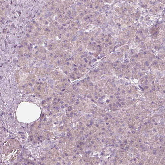EGR4 Antibody in Immunohistochemistry (Paraffin) (IHC (P))