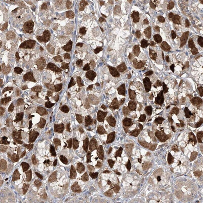 SAMD3 Antibody in Immunohistochemistry (IHC)