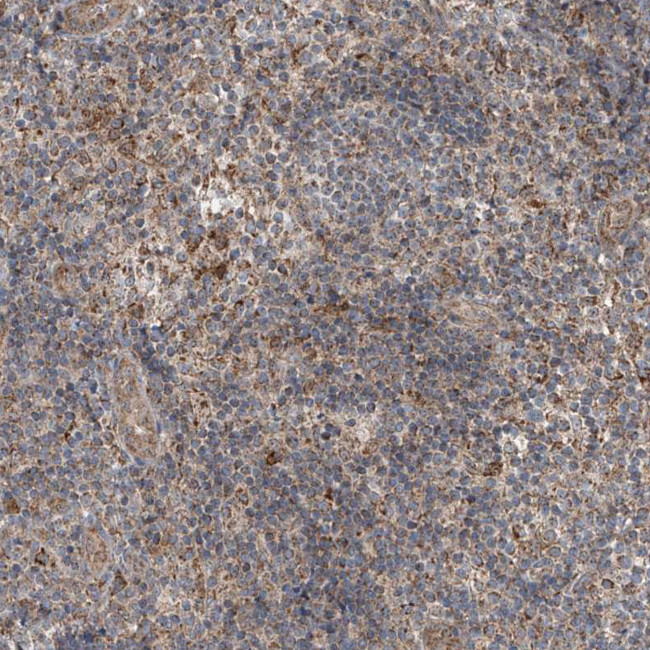 SAMD3 Antibody in Immunohistochemistry (Paraffin) (IHC (P))