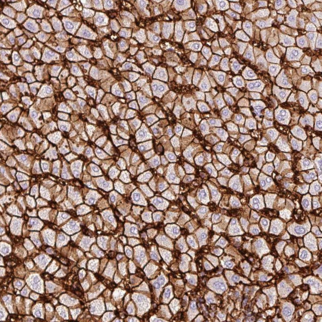 GLUT2 Antibody in Immunohistochemistry (Paraffin) (IHC (P))