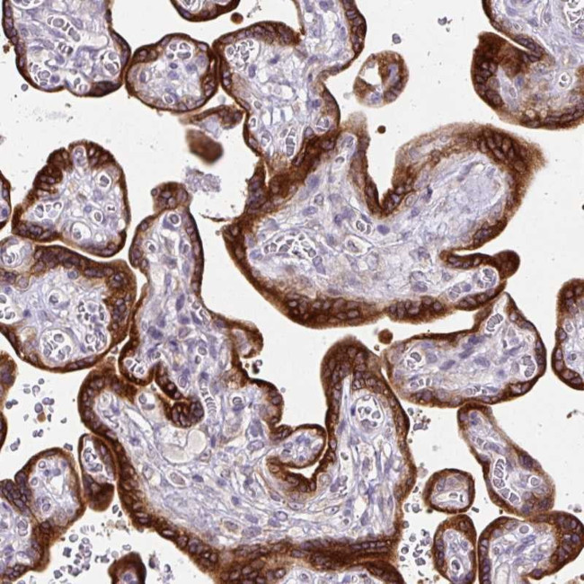 AMFR Antibody in Immunohistochemistry (Paraffin) (IHC (P))