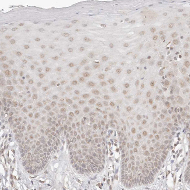 CPSF3L Antibody in Immunohistochemistry (IHC)