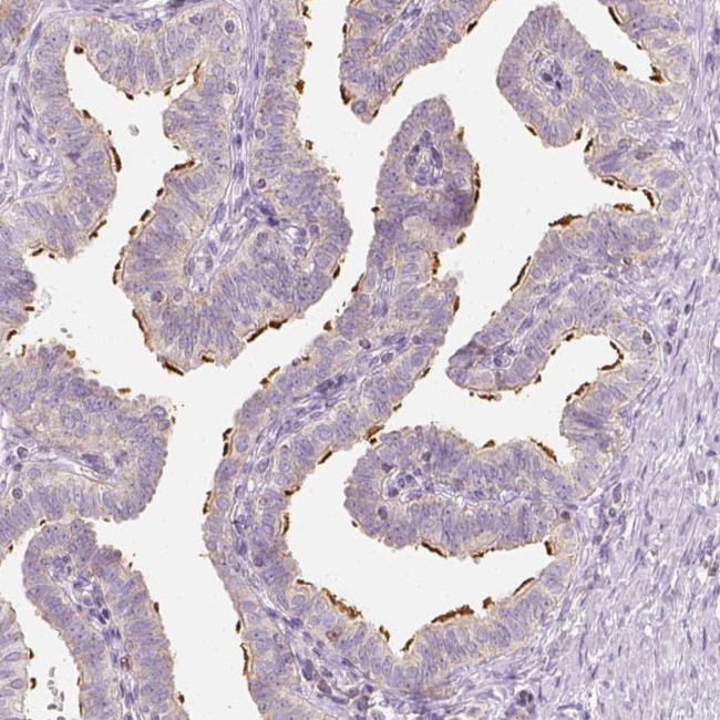 LCA5 Antibody in Immunohistochemistry (Paraffin) (IHC (P))