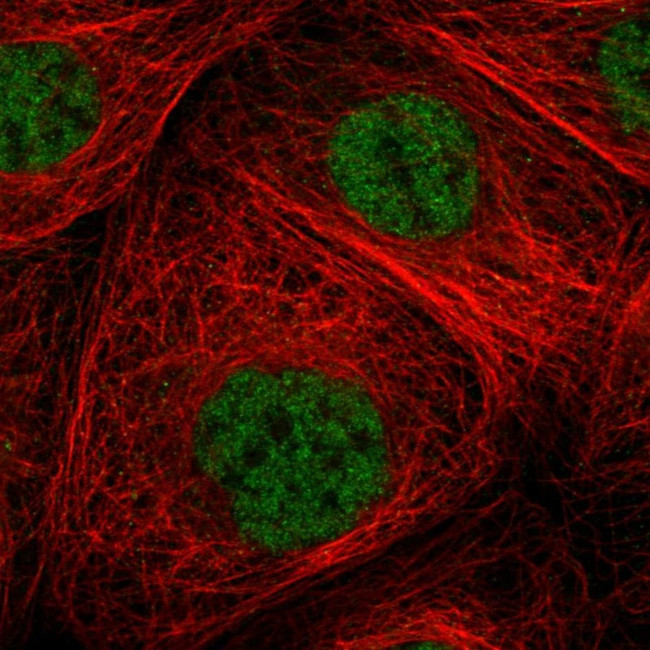 ZNF354B Antibody in Immunocytochemistry (ICC/IF)