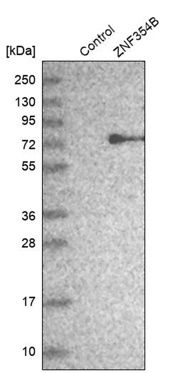 ZNF354B Antibody in Western Blot (WB)