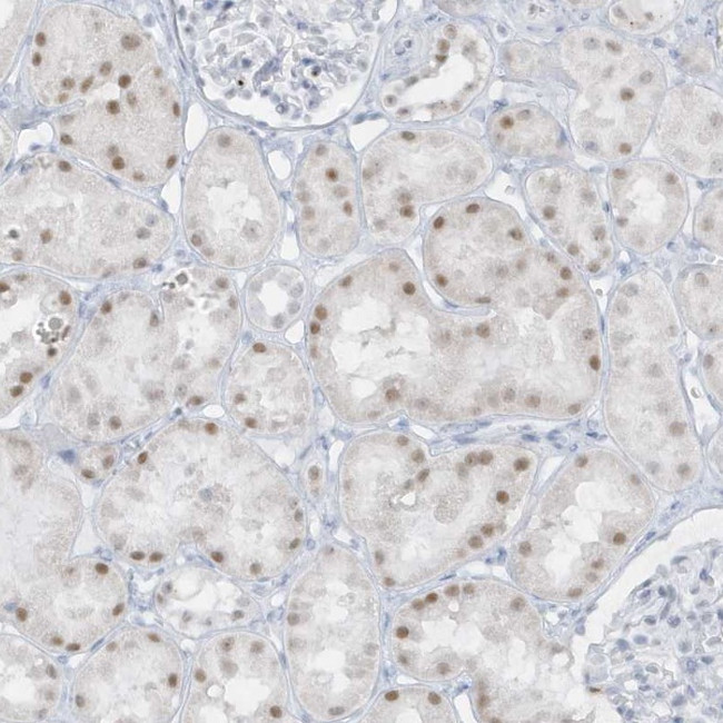 AP000322.53 Antibody in Immunohistochemistry (Paraffin) (IHC (P))