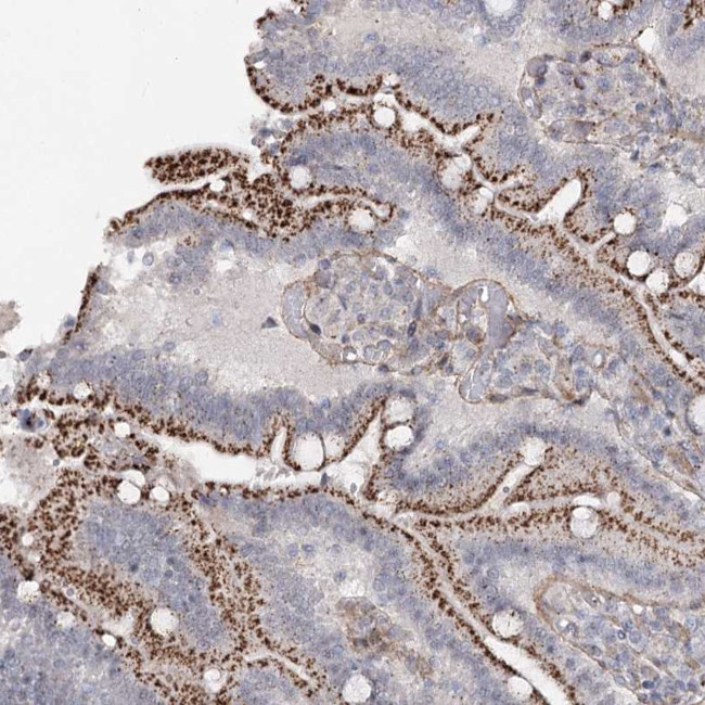 ATL2 Antibody in Immunohistochemistry (Paraffin) (IHC (P))