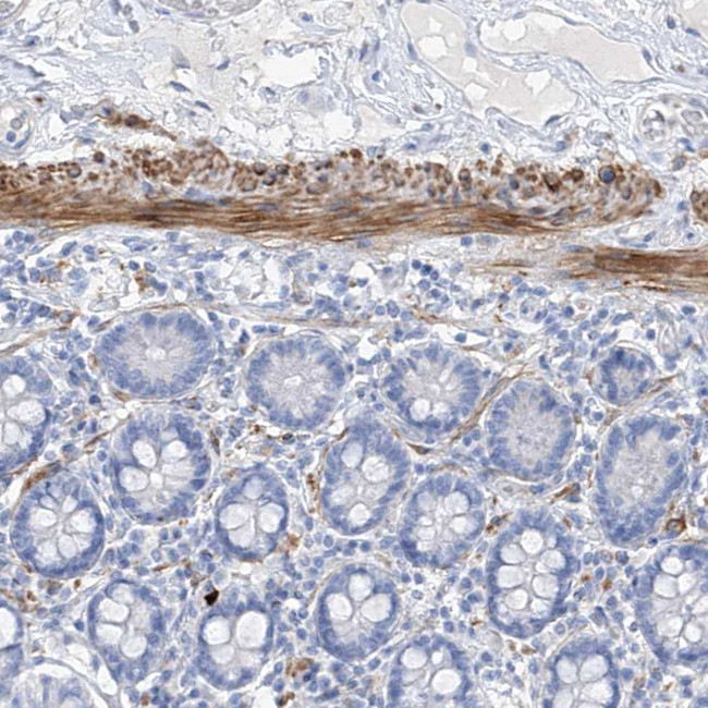C1orf85 Antibody in Immunohistochemistry (Paraffin) (IHC (P))