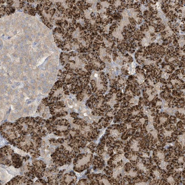 LRRN2 Antibody in Immunohistochemistry (Paraffin) (IHC (P))