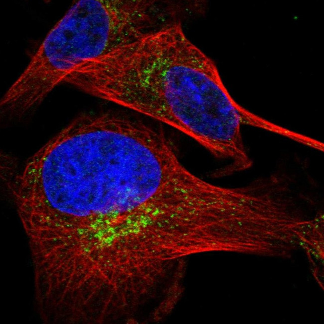 HSD17B13 Antibody in Immunocytochemistry (ICC/IF)