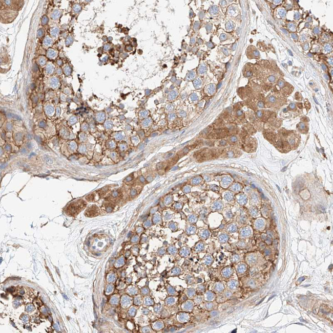 WFS1 Antibody in Immunohistochemistry (Paraffin) (IHC (P))