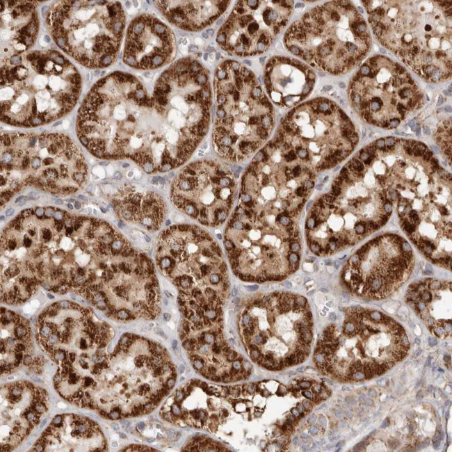 MRPS10 Antibody in Immunohistochemistry (Paraffin) (IHC (P))