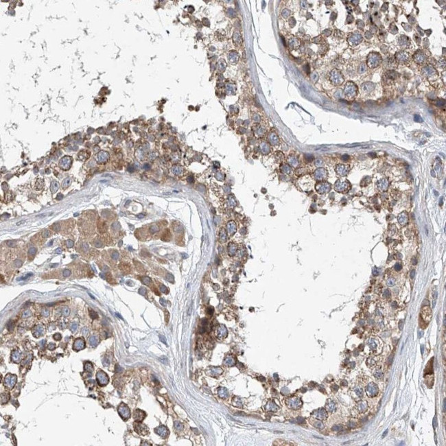 CEP85L Antibody in Immunohistochemistry (IHC)