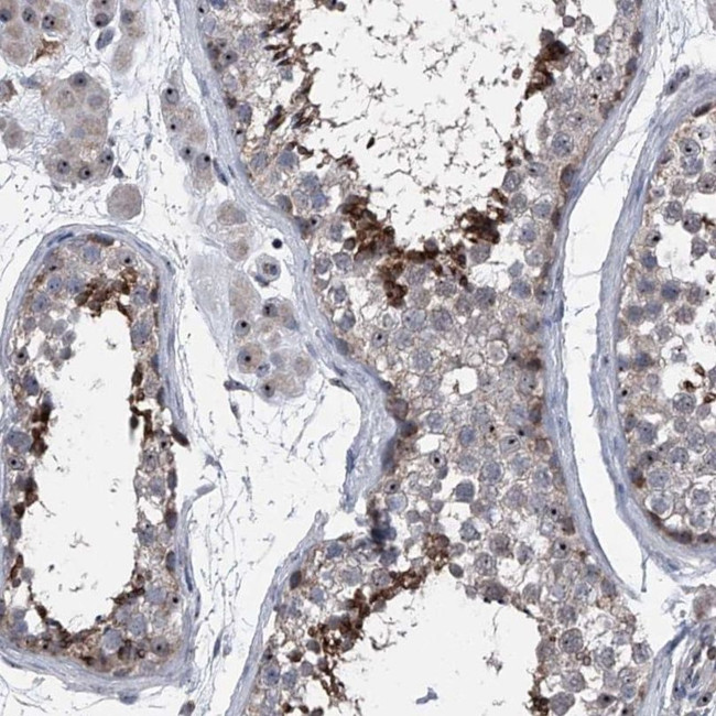 CEP85L Antibody in Immunohistochemistry (IHC)
