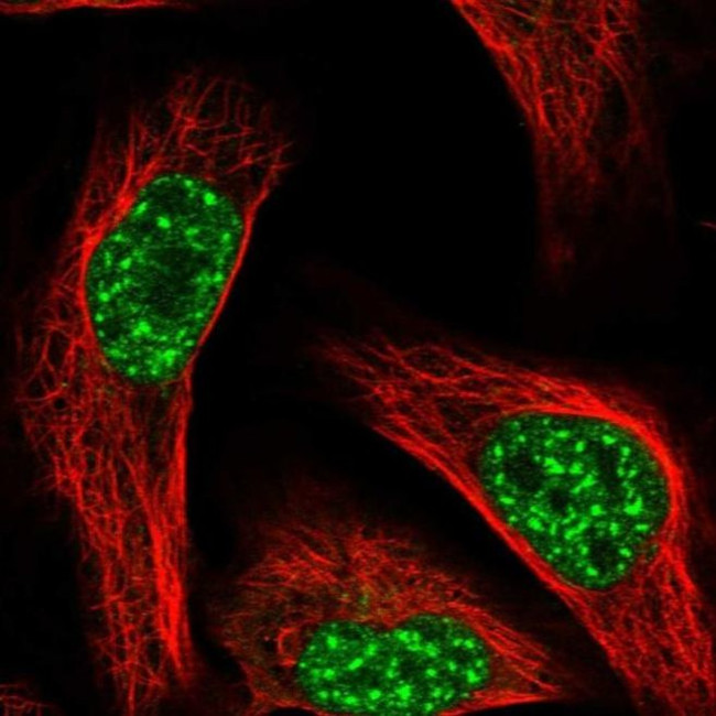 FBXL4 Antibody in Immunocytochemistry (ICC/IF)