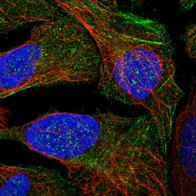LYSMD4 Antibody in Immunocytochemistry (ICC/IF)