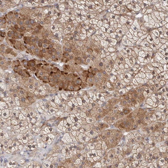 KLHL4 Antibody in Immunohistochemistry (IHC)