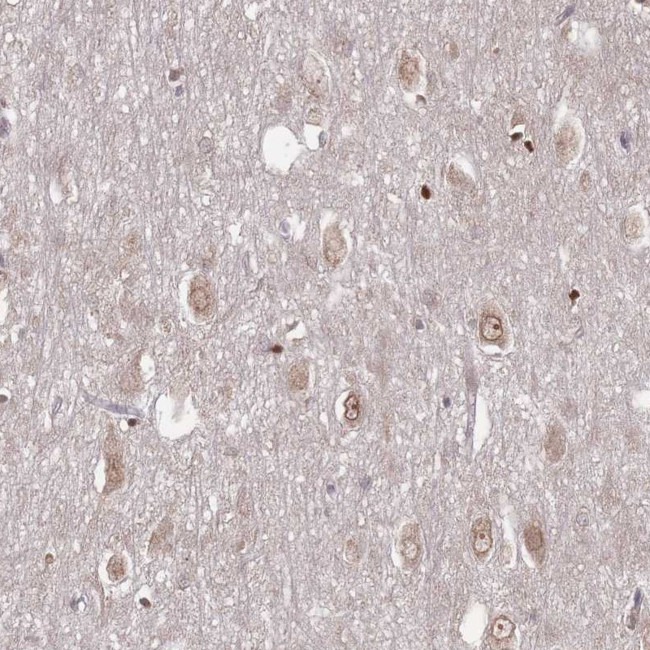 TBC1D25 Antibody in Immunohistochemistry (Paraffin) (IHC (P))