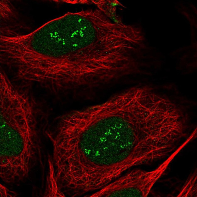TSEN15 Antibody in Immunocytochemistry (ICC/IF)