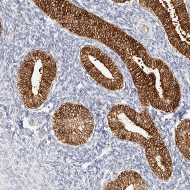 ZRANB1 Antibody in Immunohistochemistry (Paraffin) (IHC (P))