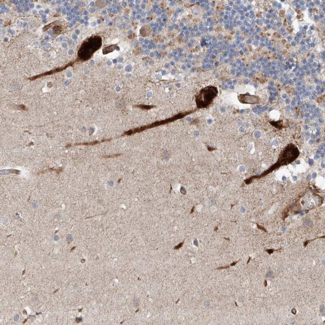 USF3 Antibody in Immunohistochemistry (IHC)
