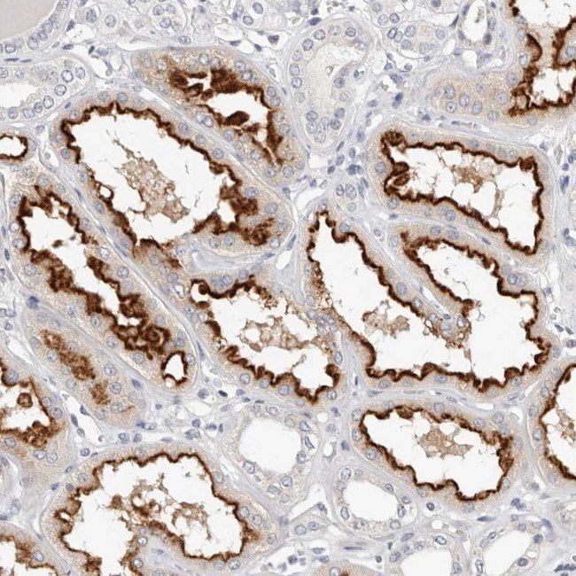 TMEM63B Antibody in Immunohistochemistry (Paraffin) (IHC (P))