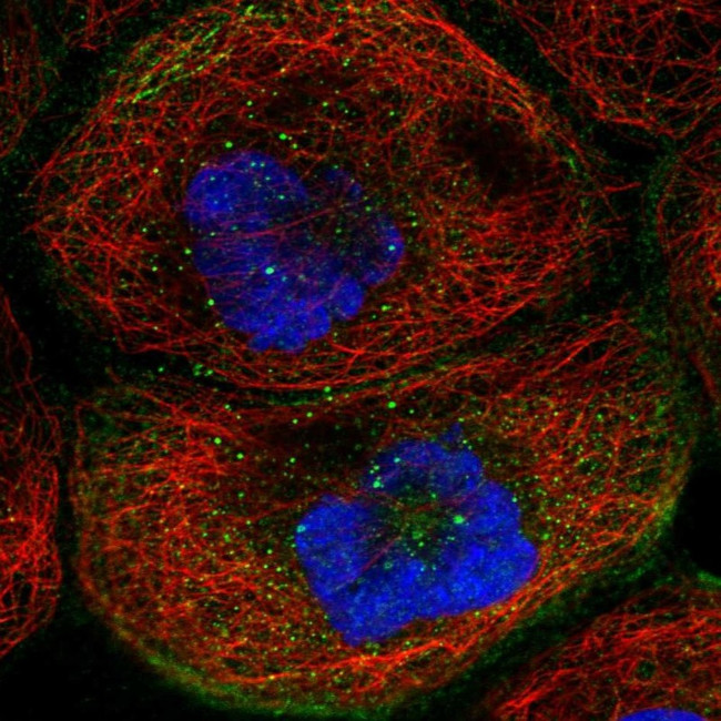 TMEM63B Antibody in Immunocytochemistry (ICC/IF)