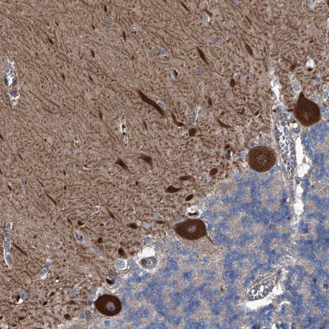 KIF13A Antibody in Immunohistochemistry (Paraffin) (IHC (P))