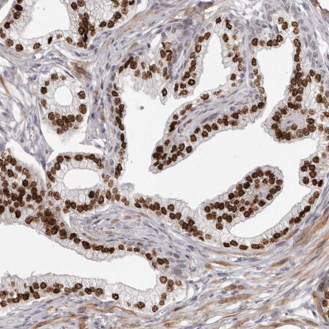 SRP19 Antibody in Immunohistochemistry (Paraffin) (IHC (P))