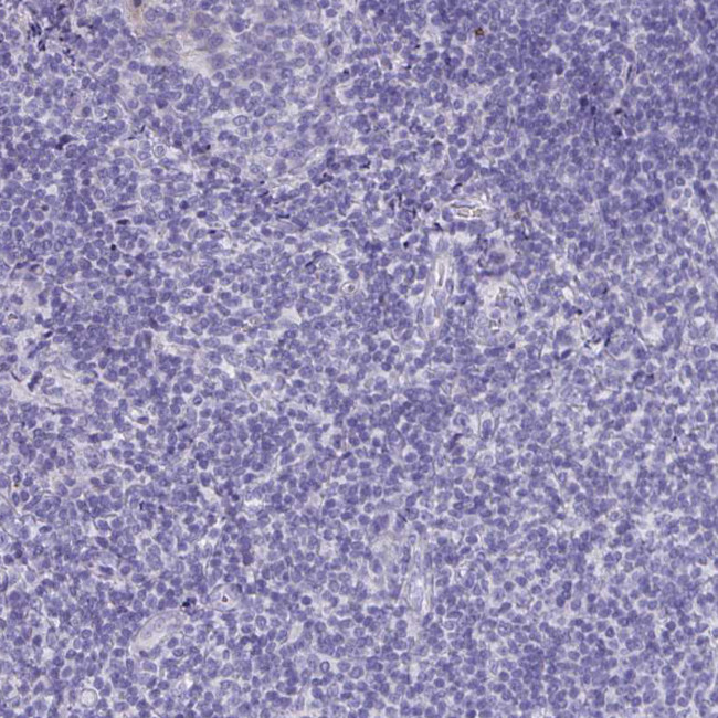 KIAA1751 Antibody in Immunohistochemistry (Paraffin) (IHC (P))