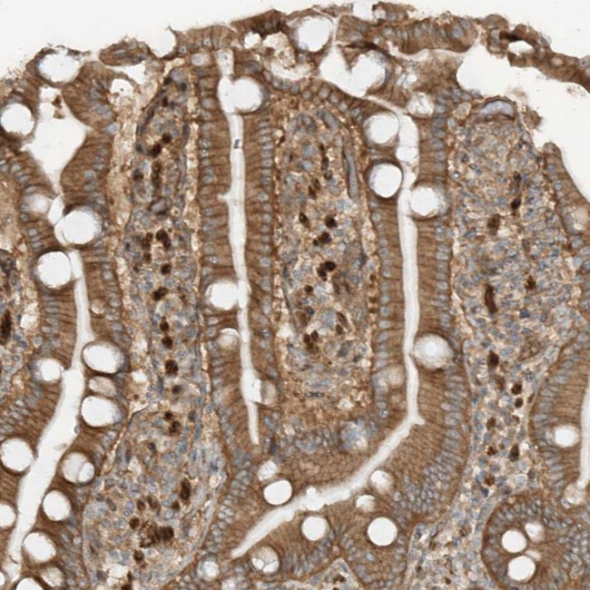 SDCCAG3 Antibody in Immunohistochemistry (Paraffin) (IHC (P))