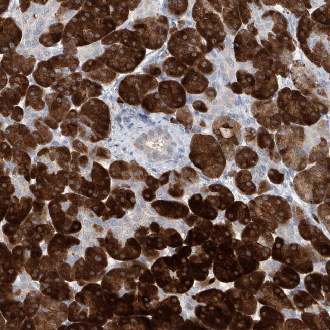 Asparagine Synthetase Antibody in Immunohistochemistry (IHC)