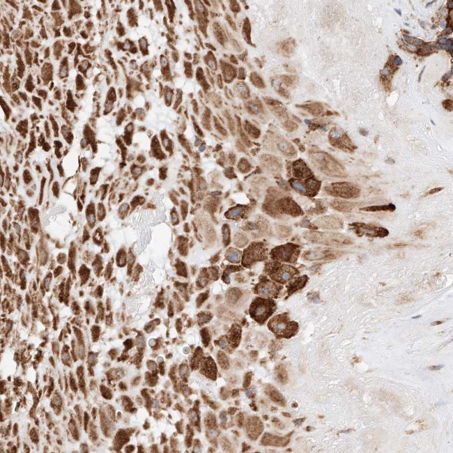 ATP9B Antibody in Immunohistochemistry (Paraffin) (IHC (P))