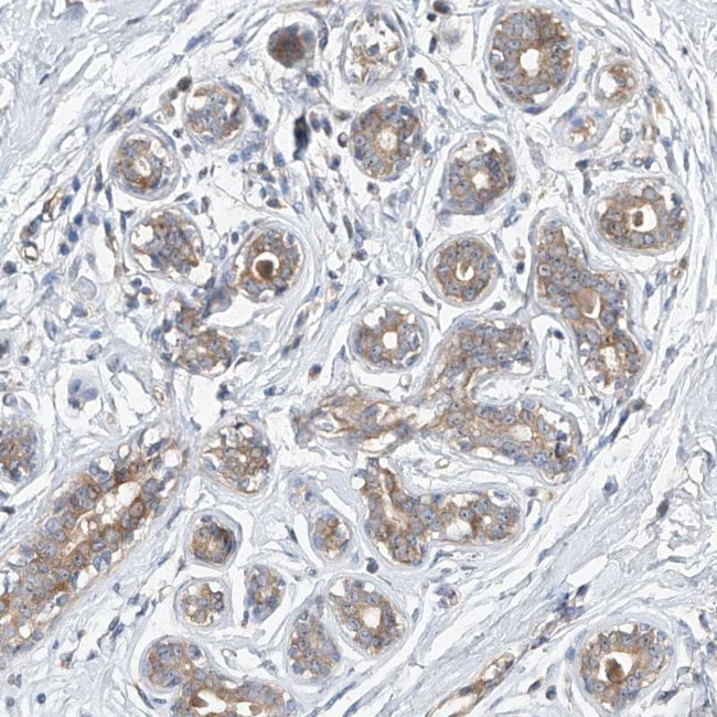 DIRAS3 Antibody in Immunohistochemistry (Paraffin) (IHC (P))