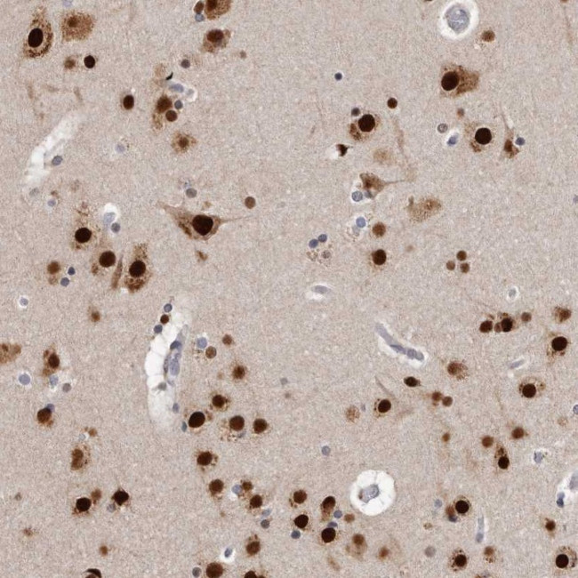 KHDRBS2 Antibody in Immunohistochemistry (Paraffin) (IHC (P))
