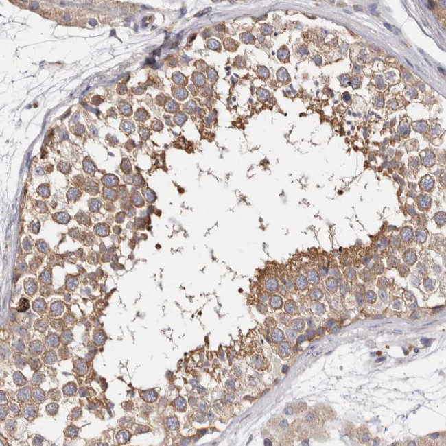 FAM167B Antibody in Immunohistochemistry (Paraffin) (IHC (P))