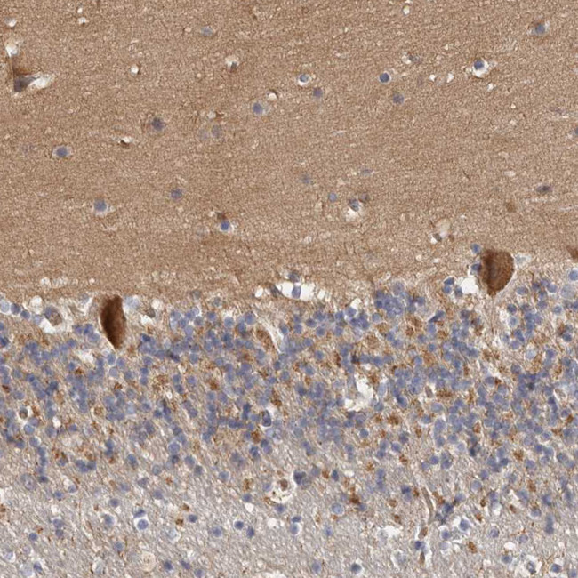 FAM189A2 Antibody in Immunohistochemistry (Paraffin) (IHC (P))