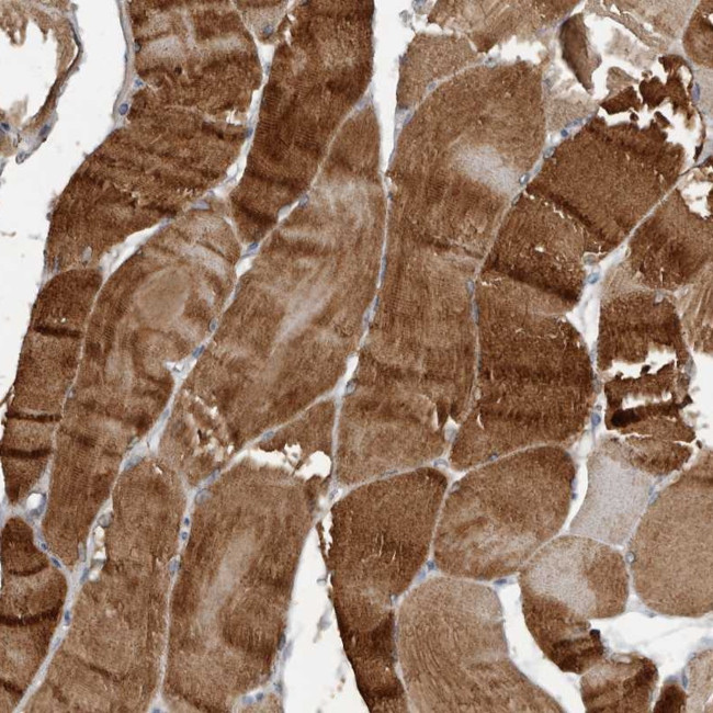 HYAL4 Antibody in Immunohistochemistry (Paraffin) (IHC (P))
